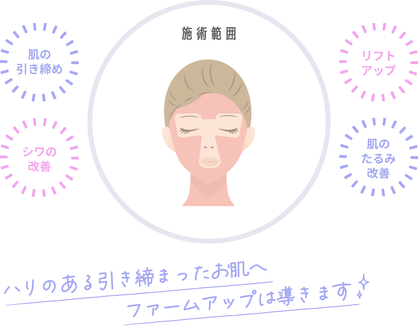 ファームアップ