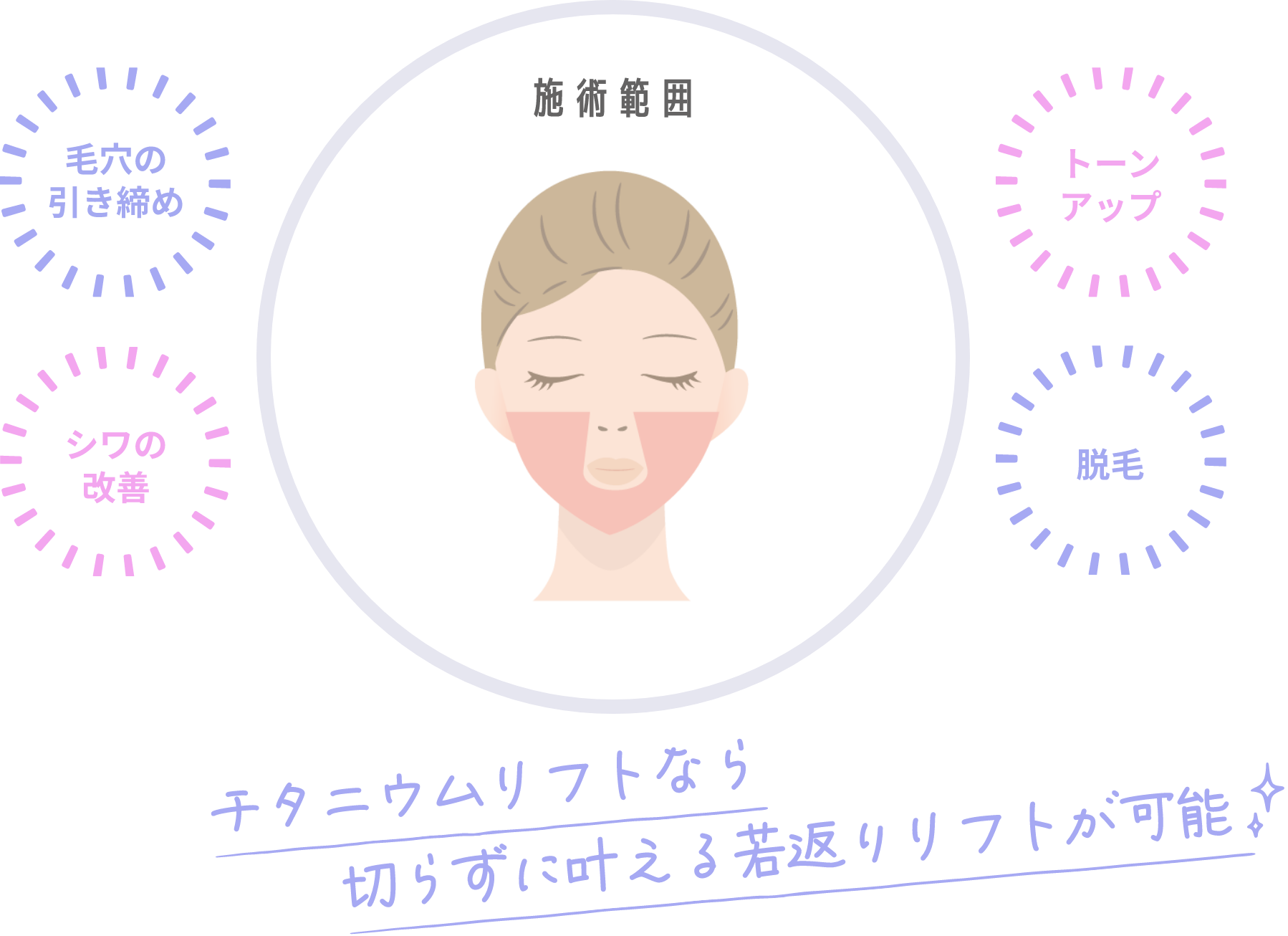 チタニウムリフト